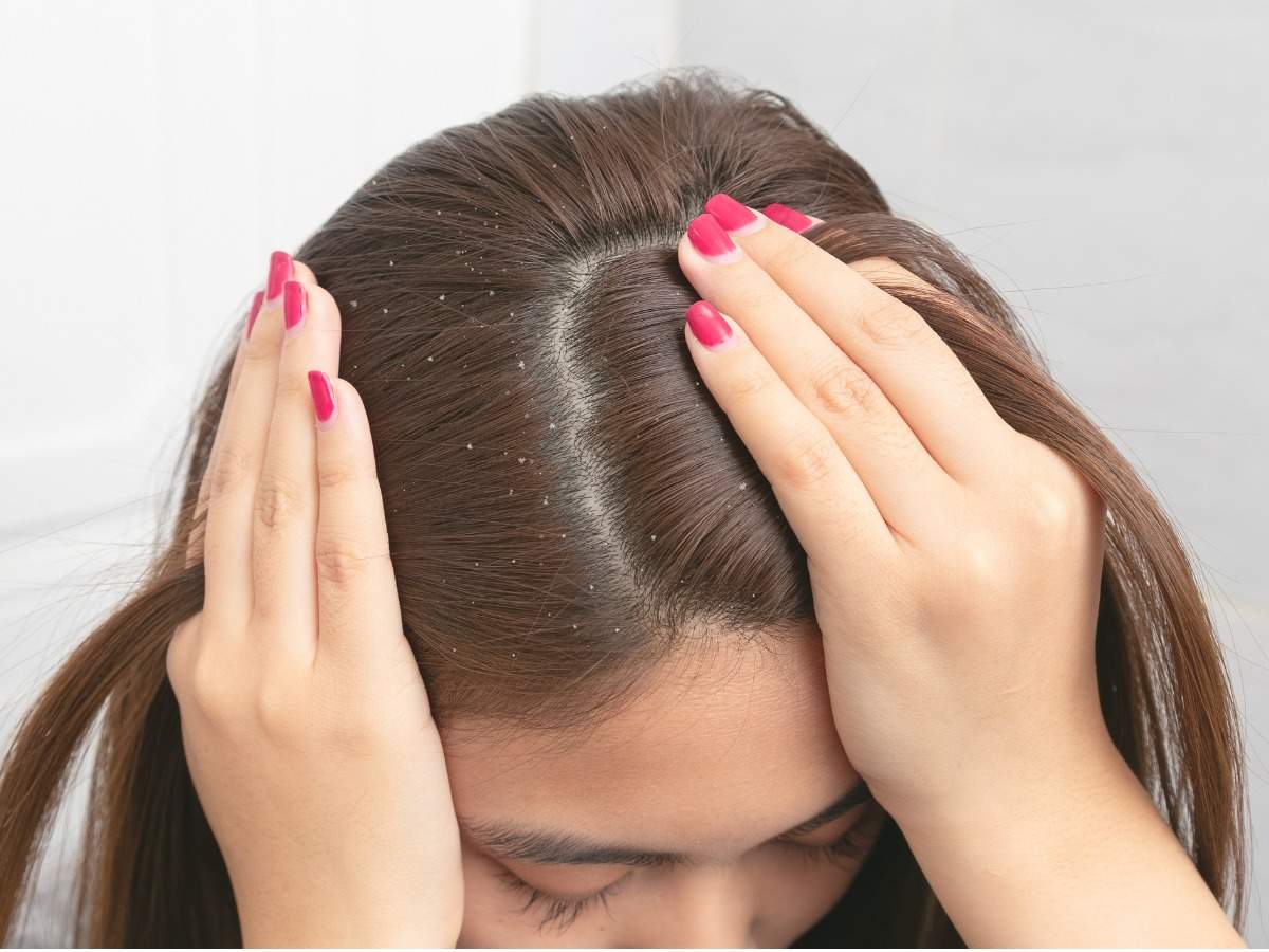 Hair loss treatment
